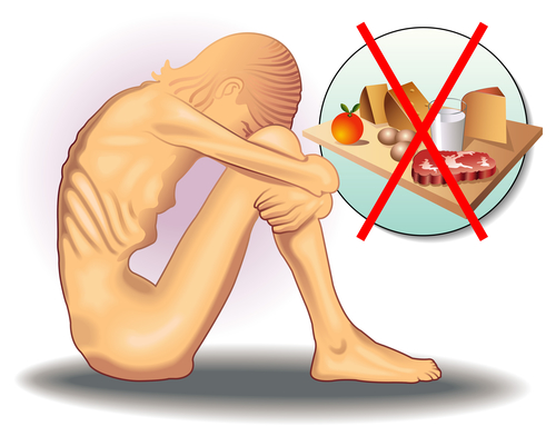 Trastornos alimenticios  La importancia del entorno para una buena alimentación