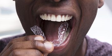 Bruxismo, apretar los dientes en exceso